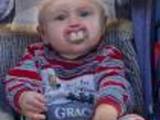 Baby mit Hasenz&auml;hnen