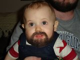 Baby mit schnellen Haarwuchs