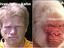 Kahn&acute;s Klon