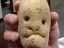 Kartoffelgesicht