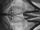 17_-PrisonBreak-_17